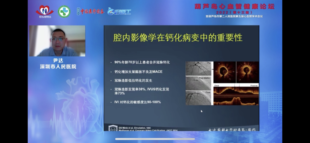 葫蘆島心血管健康論壇?2022｜創(chuàng)新驅(qū)動(dòng)發(fā)展，不斷提升心血管疾病救治能力(圖11)